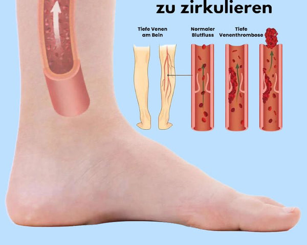 FeetRelief™️ - Schnell schmerzfreie Beine in nur 20 Minuten