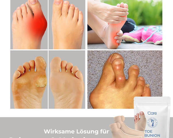 AlignToes™ - Bequeme Zehenunterstützung für gesunde und schöne Füße!