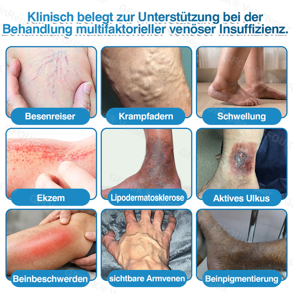 🇩🇪🥇🏆GFOUK® VeinRepair Mikronadel-Pflasterrolle⚡Sofortige Linderung, langfristige Ergebnisse