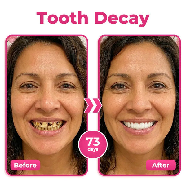 Dentiora™ NH-10 Enamel & Gum Advanced Therapy Zahnserum – Zahnschmelz stärken & Zahnempfindlichkeit lindern