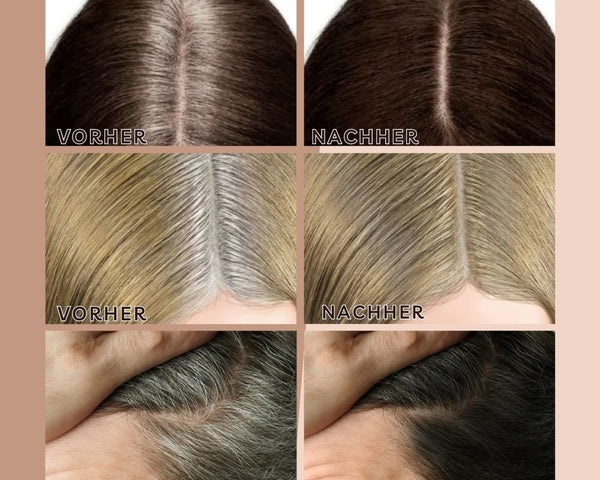 HairBlend™ - Bye-Bye Haaransatz | 1+1 GRATIS NUR TEMPORÄR