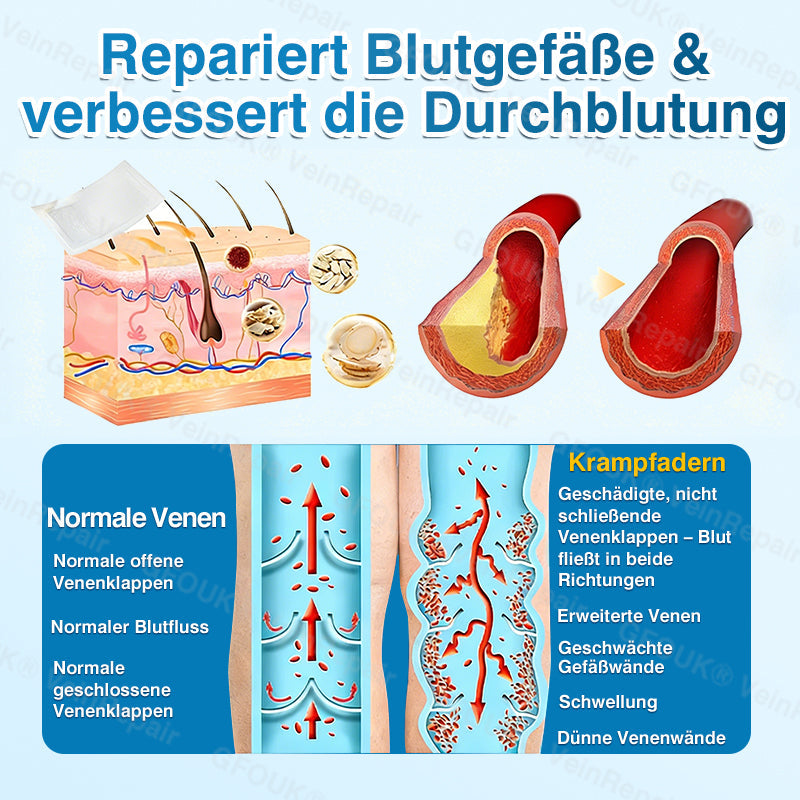 🇩🇪🥇🏆GFOUK® VeinRepair Mikronadel-Pflasterrolle⚡Sofortige Linderung, langfristige Ergebnisse