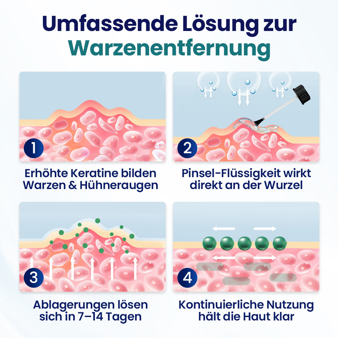 Wartelle™ Warzen-Entfernungsflüssigkeit ✨