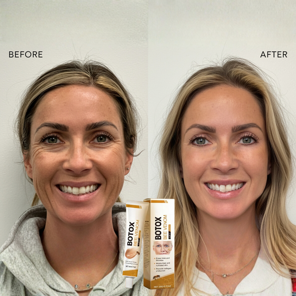 1+1 GRATIS | Apiluxe™ Bienengift Anti-Aging-Creme | Für Straffer & Glatter Wirkende Haut