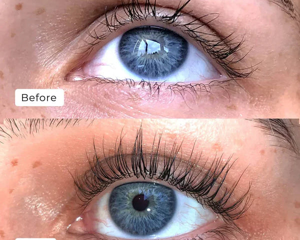 1+1 GRATIS WimperSerum™ - Sofort Traumwimpern!