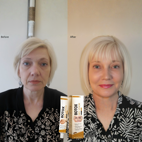 1+1 GRATIS | Apiluxe™ Bienengift Anti-Aging-Creme | Für Straffer & Glatter Wirkende Haut