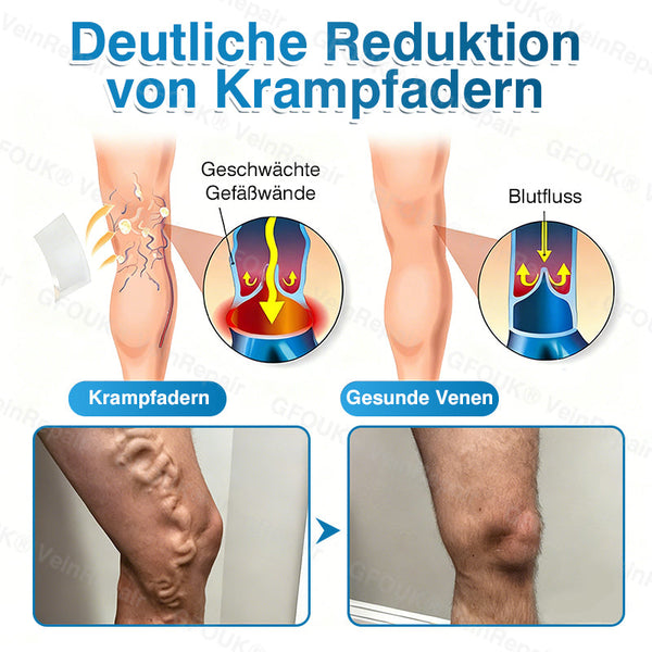 🇩🇪🥇🏆GFOUK® VeinRepair Mikronadel-Pflasterrolle⚡Sofortige Linderung, langfristige Ergebnisse