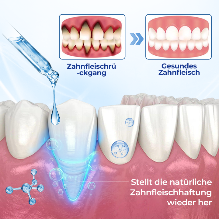 1+1 GRATIS | BeeTakt Zahnfleisch-Repair Lösung