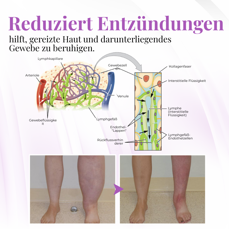 Venalisse™ Beinpflege-Creme – Für Leichtere, Erfrischte & Gepflegt Aussehende Beine