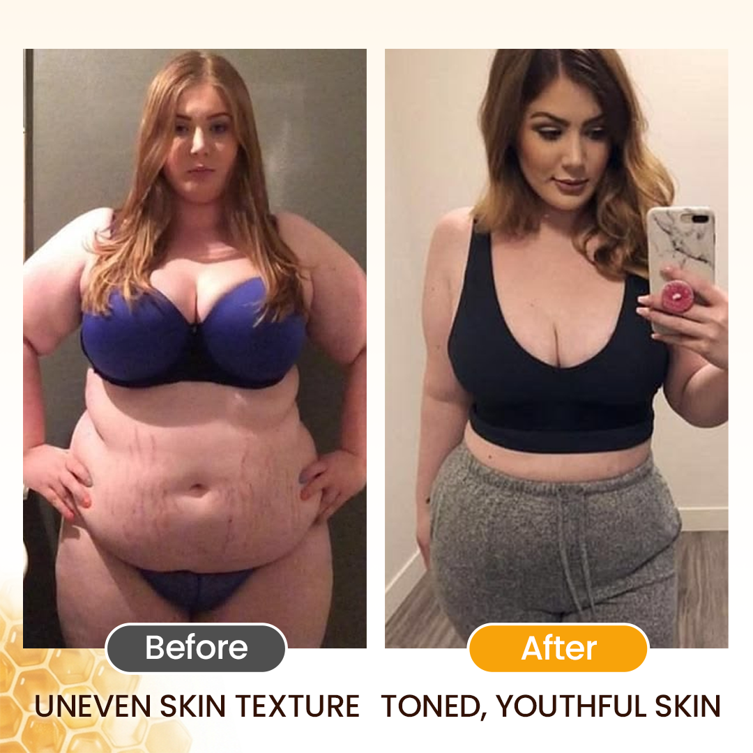 BeeSculpt™ Körperstraffungsöl – Für weniger Cellulite & definiertere Konturen