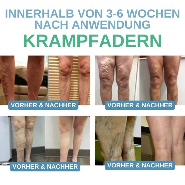 1+1 Gratis | PEARLMOON™ FormSocken