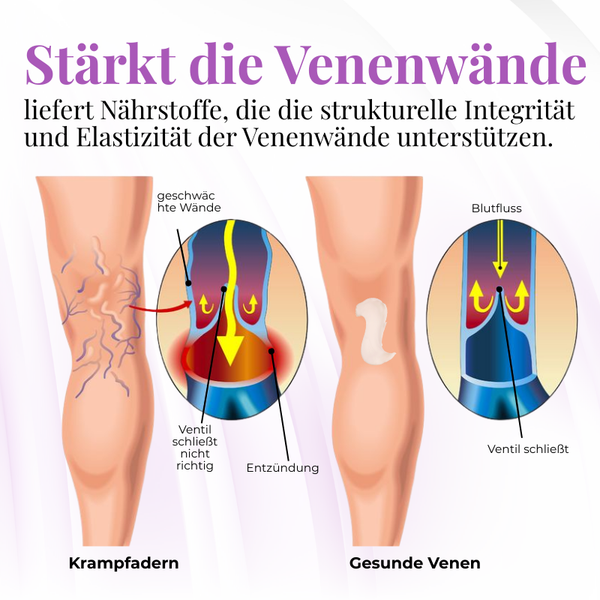 Venalisse™ Beinpflege-Creme – Für Leichtere, Erfrischte & Gepflegt Aussehende Beine