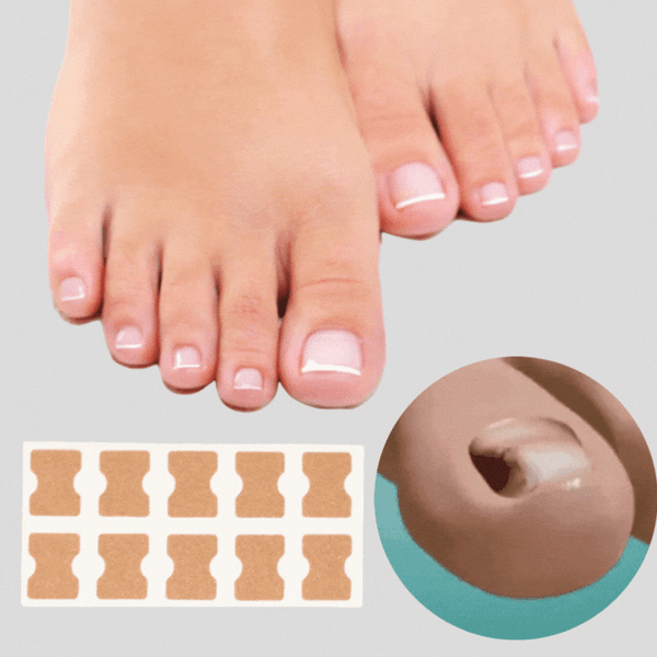 50% Rabatt || NagelWunder™ | Professionelle Korrekturpflaster für schöne, gesunde Nägel