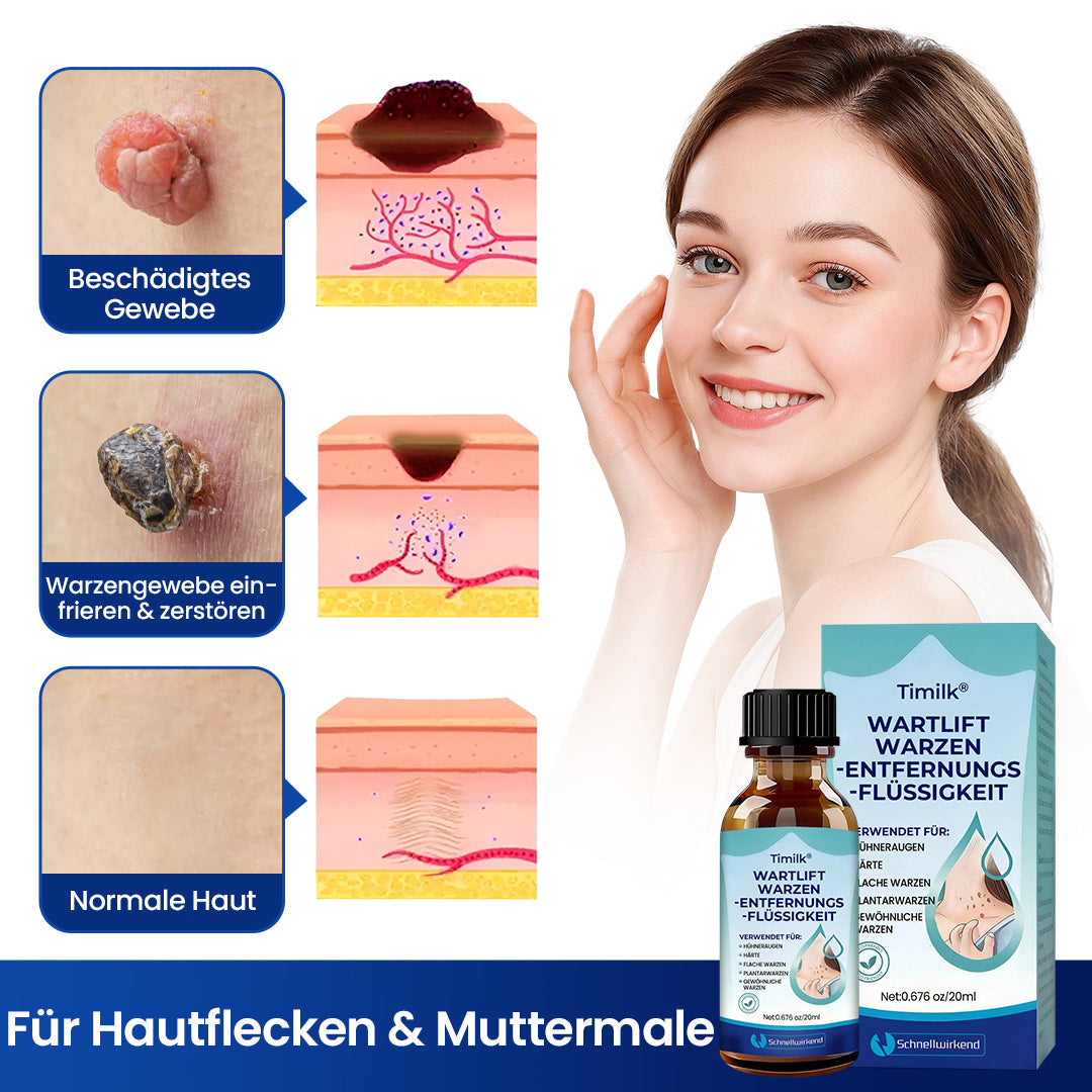 Wartelle™ Warzen-Entfernungsflüssigkeit ✨