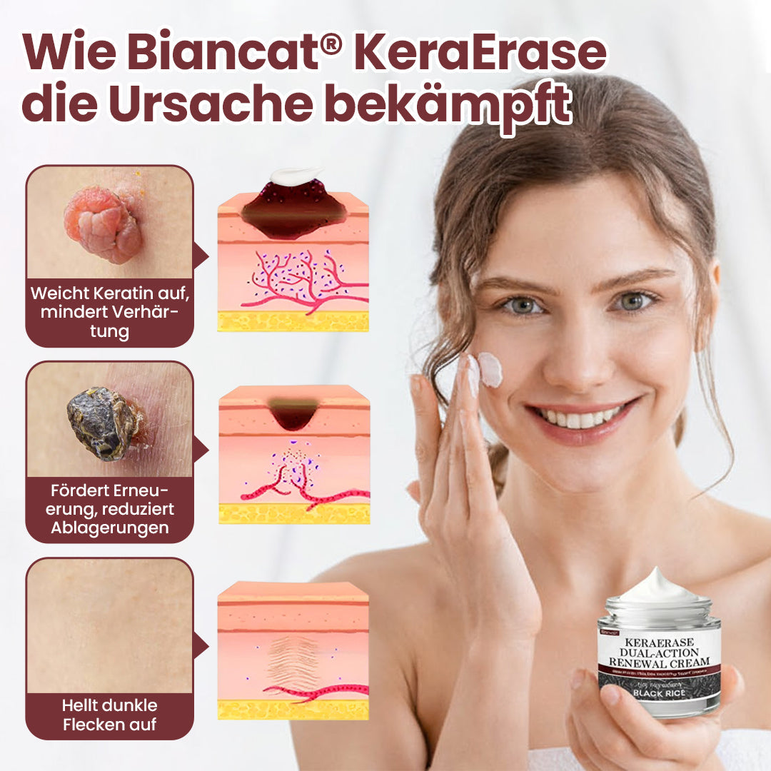 KeraErase Dual-Action Erneuerungscreme