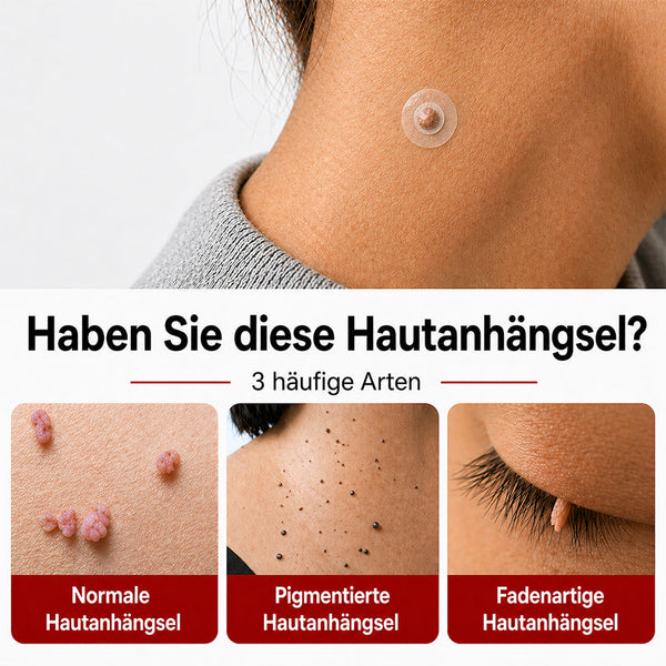 Hautpflaster zur Skin-Tag-Entfernung