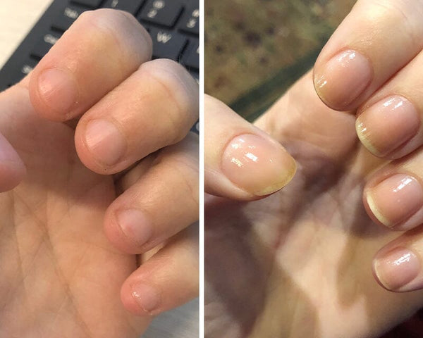 NagelElixier™ Revitalisierende Nagelbehandlung