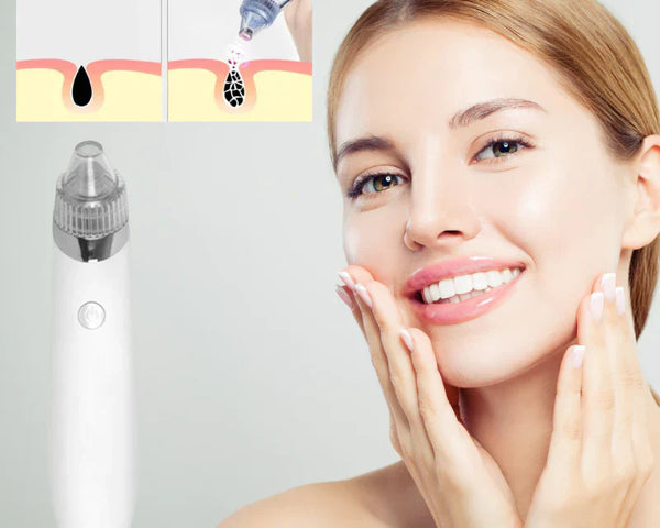 PoreCleaner™ | Effektiver Porenreiniger für klare Haut