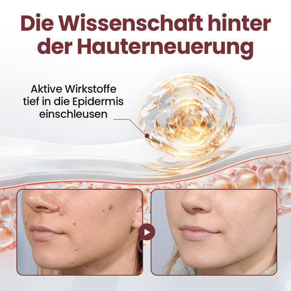 KeraErase Dual-Action Erneuerungscreme