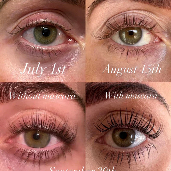 1+1 Gratis | Wimpernserum™ | Geben Sie dünnen, kurzen Wimpern Schwung