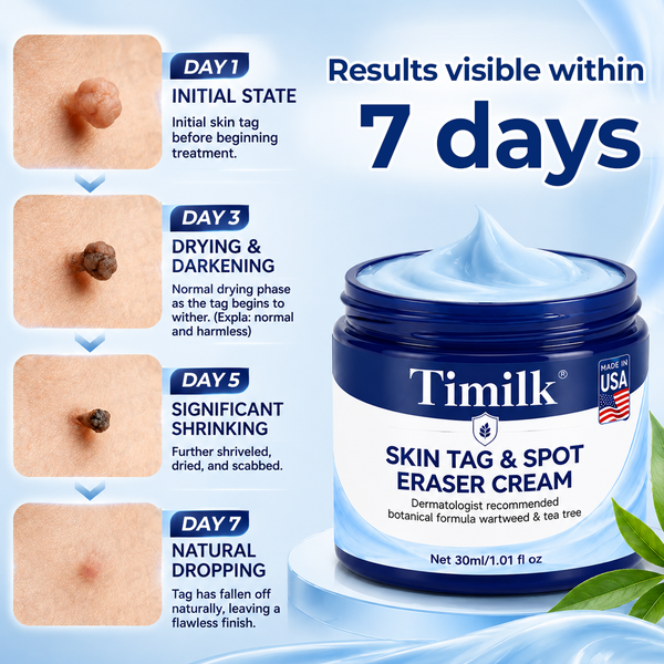 DermaVex™ 7-Tage Entferner Creme – Für Hautanhängsel & sichtbare Hautunreinheiten