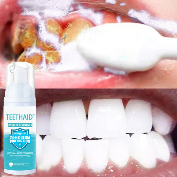BrightMint™ Premium Mundspülung – Für Frischen Atem & Strahlend Gepflegte Zähne