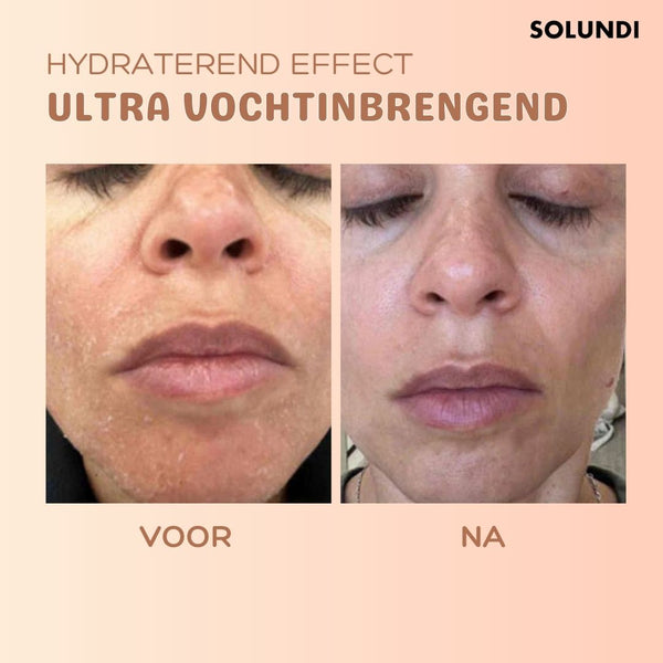 (1+1 GRATIS ) SmoothBalm™ Anti-Falten-Hauterneuerungsbalsam