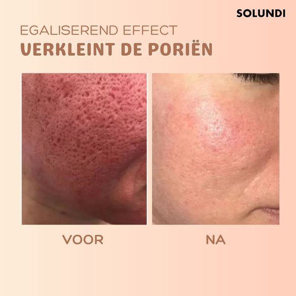(1+1 GRATIS ) SmoothBalm™ Anti-Falten-Hauterneuerungsbalsam