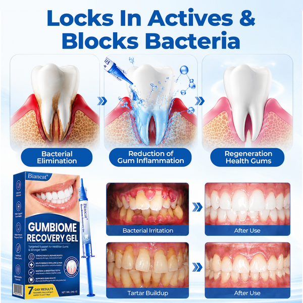 GumRevia™ GumBiome Recovery Gel – Gezielte Pflege für Zahnfleisch & Zahnfleischrückgang