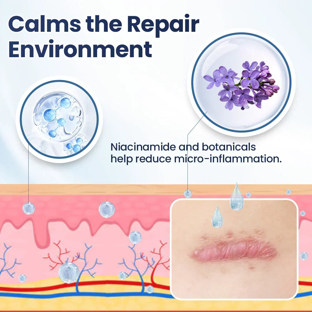 Revella™ Narbenpflege-Gel – Für Ein Ebenmäßigeres & Gepflegteres Hautbild