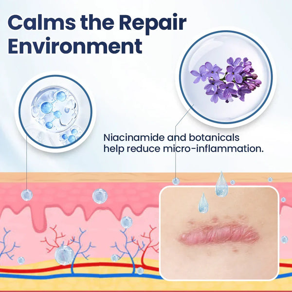 Revella™ Narbenpflege-Gel – Für Ein Ebenmäßigeres & Gepflegteres Hautbild