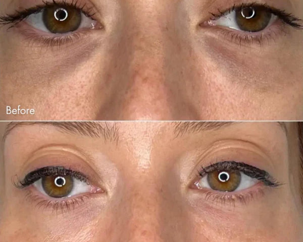 1+1 Gratis | FrischeAugen™ Sofortige Auffrischung unter den Augen