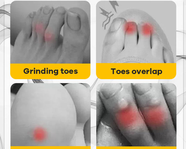 ToeProtect™ – Ultimativer Schutz für Ihre Zehen gegen Blasen und Reibung