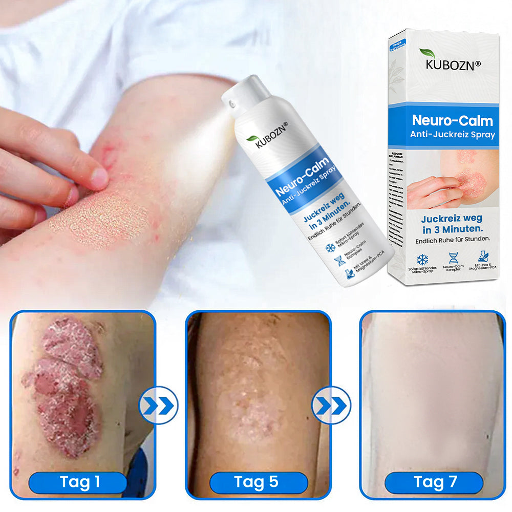 Magnesium Kräuter-Spray für Psoriasis-neigende Haut