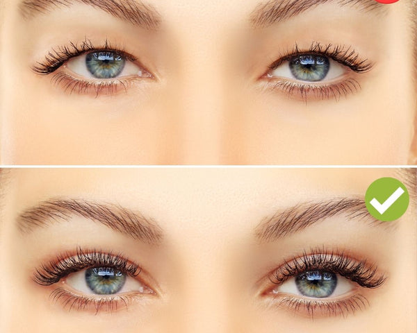 Brightie™ - Unsichtbare Lidstraffungsstreifen Kit | 1+1 Gratis