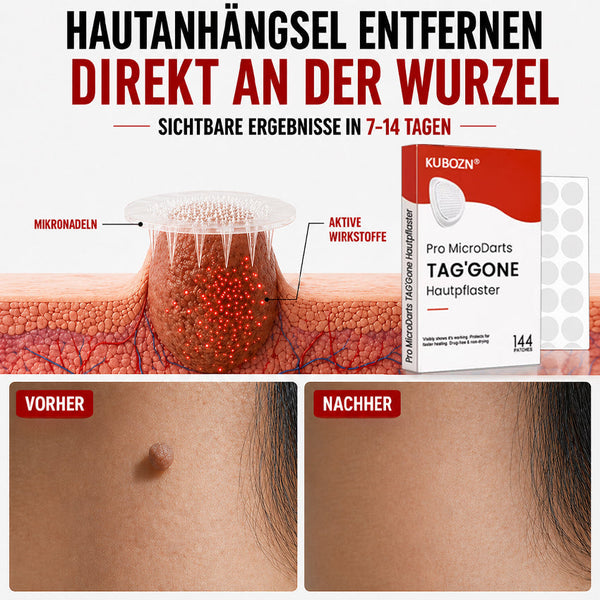 Hautpflaster zur Skin-Tag-Entfernung