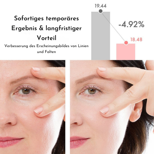 2+1 Gratis | JugendlicherBalken™ Glatte und strahlende Augen