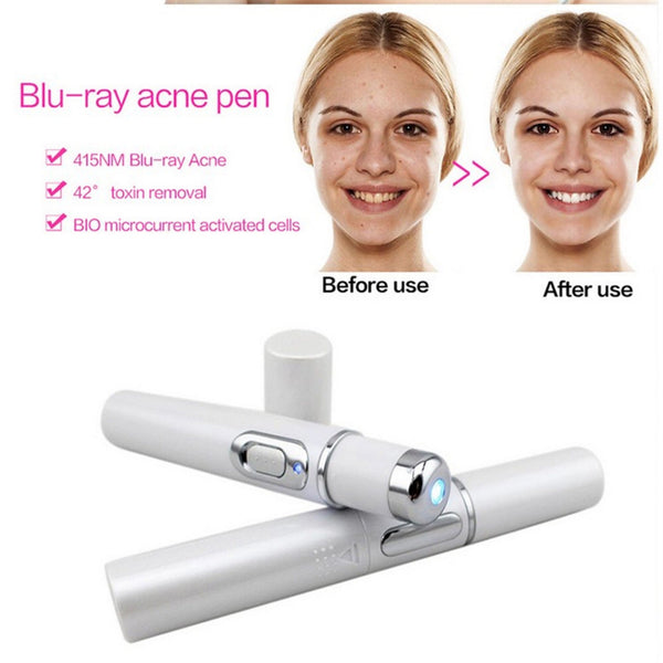Laser Therapy™ | Keine Pickel und Akne mehr!