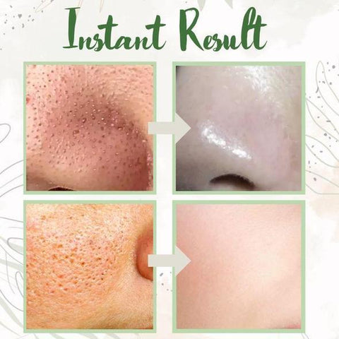 1+1 Gratis | BioBalance Mask™ | Grüner Tee Tiefenreinigungsmaske🍃