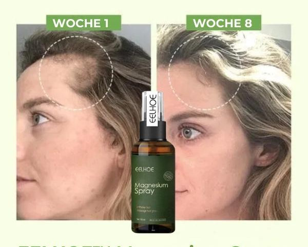 EELHOE™ Magnesium Serum