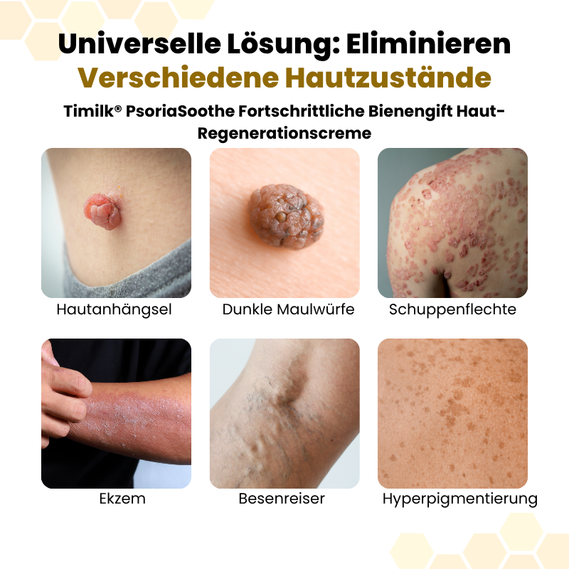 PsoriaSoothe Fortschrittliche Bienengift Haut-Regenerationscreme