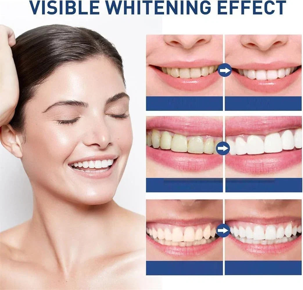SmileLuxe™ Zahn-Polish – Sofort Strahlenderes Lächeln in Sekunden