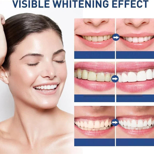 SmileLuxe™ Zahn-Polish – Sofort Strahlenderes Lächeln in Sekunden