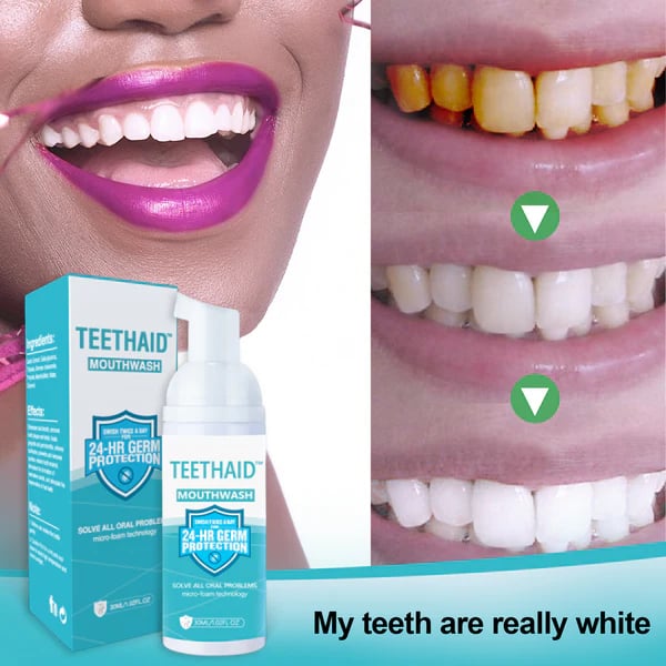 BrightMint™ Premium Mundspülung – Für Frischen Atem & Strahlend Gepflegte Zähne