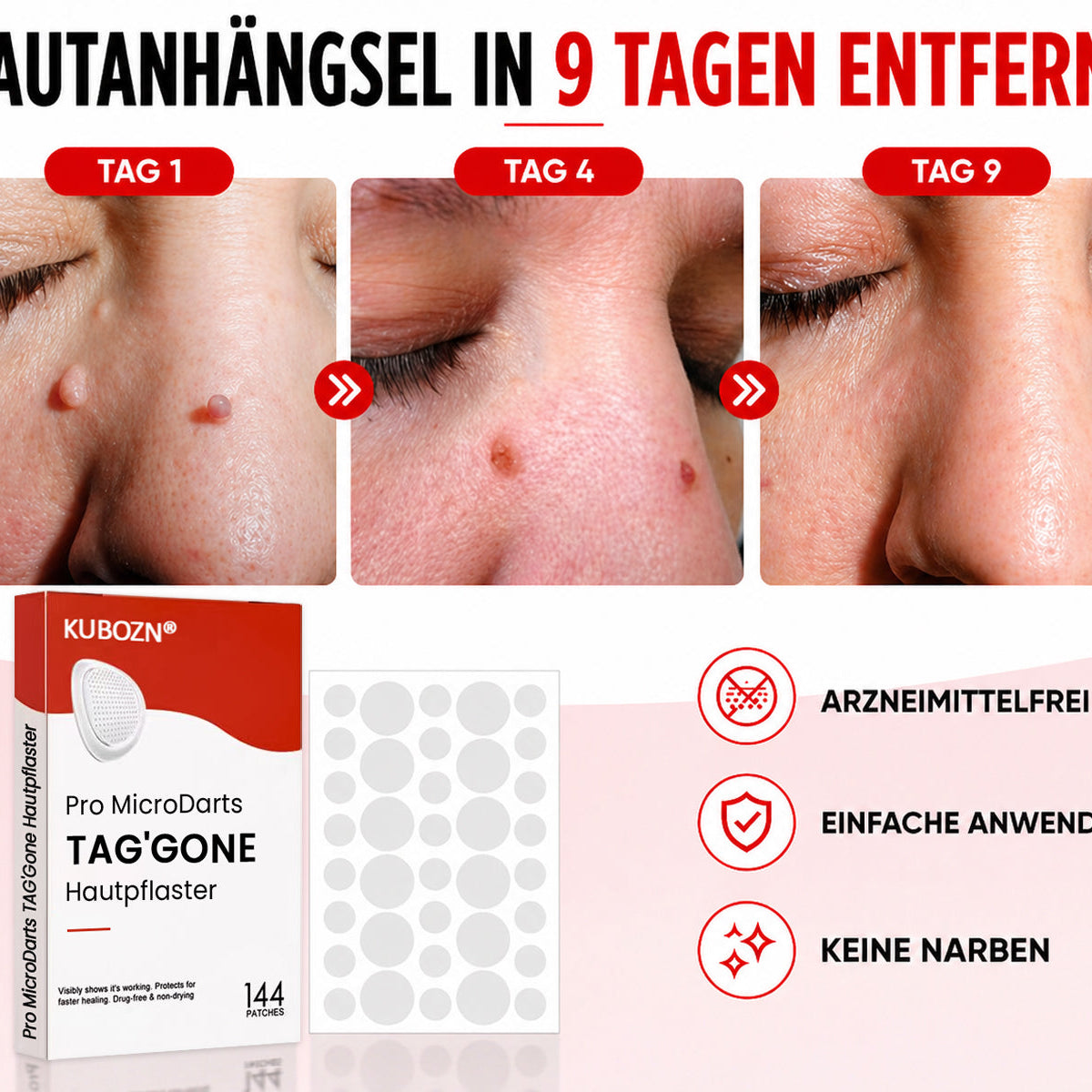 Hautpflaster zur Skin-Tag-Entfernung
