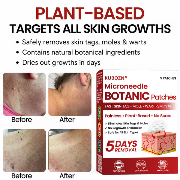 SkinClear™ Mikronadel-Pflaster zur Hautanhängsel-Entfernung – Für Glattere Haut