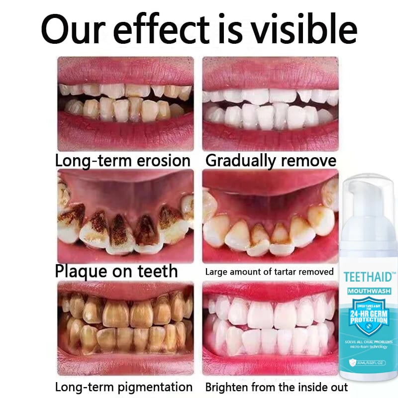 BrightMint™ Premium Mundspülung – Für Frischen Atem & Strahlend Gepflegte Zähne
