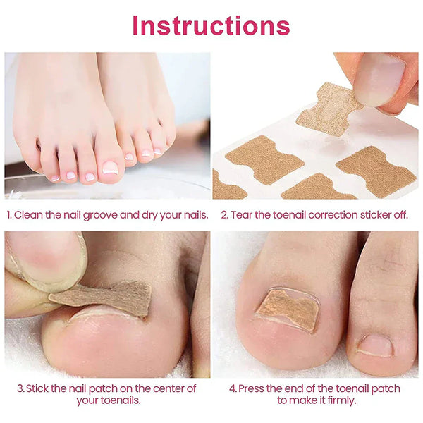 NägelNachbessern™ Pflegeaufkleber für Nagelkorrekturen