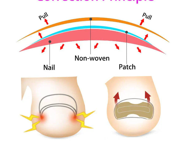 NägelNachbessern™ Pflegeaufkleber für Nagelkorrekturen