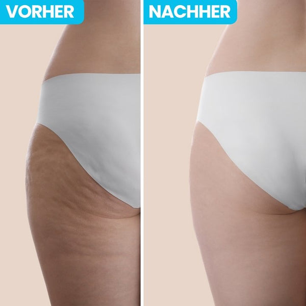60% Rabatt | Inovagoods™️ 5-in-1 Anti-Cellulitis Infrarot-Massagegerät